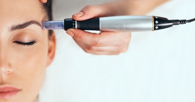 How Many PRP Microneedling Treatments are Needed? image