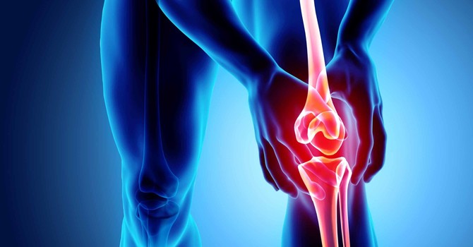 Sharp Stabbing Knee Pain Comes and Goes image