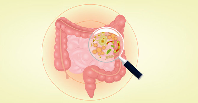 How to Restore Gut Health After Stomach Flu image