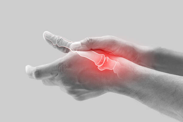 Peptides for Arthritis: Relief and Treatment in San Diego, CA