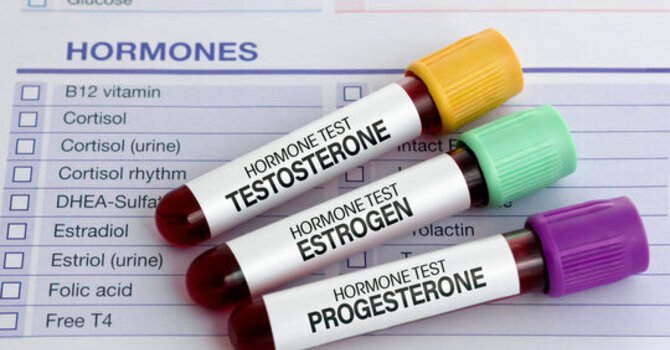 When is the Best Time to Test for Hormone Imbalance?  image