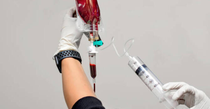 EBOO Therapy in San Diego image