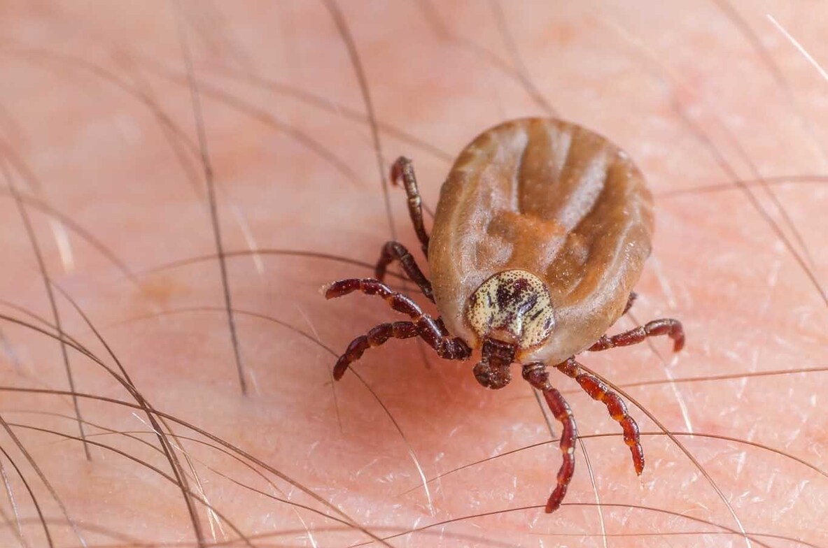 Ozone for Lyme Disease in San Diego