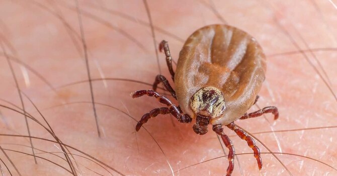 Ozone for Lyme Disease in San Diego image