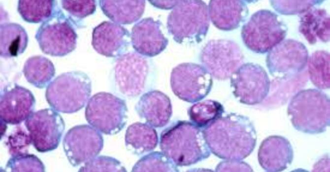 Ozone Therapy for EBV in San Diego: A Powerful Solution for Healing image