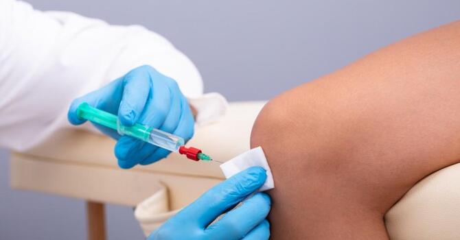 Prolozone for Knee Pain in San Diego image