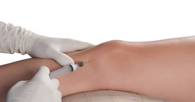 Why Is PRP Controversial? image