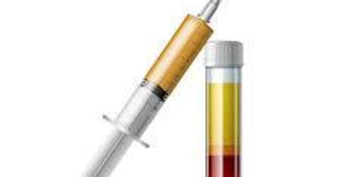 What is the New Alternative to PRP? image