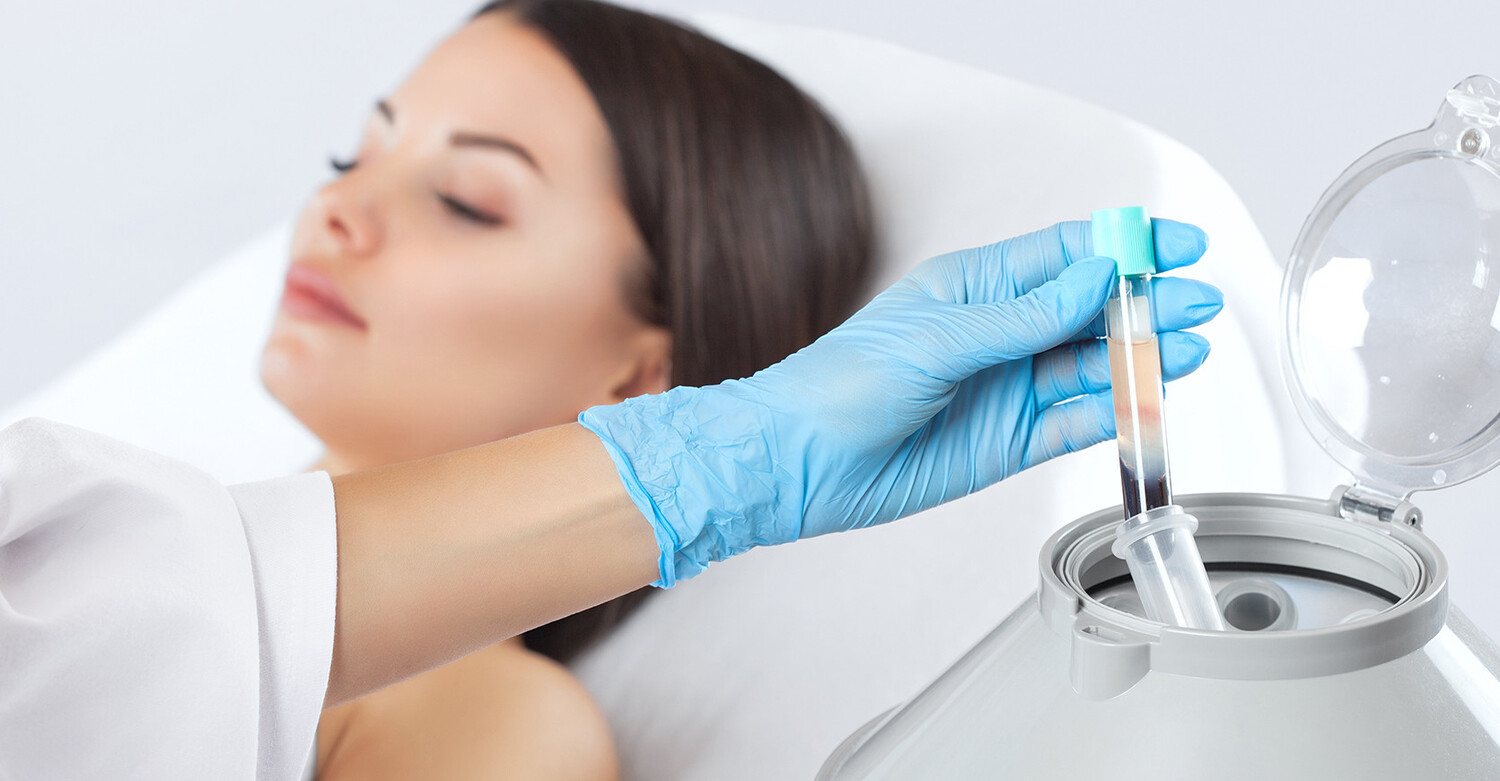How Often Should You Do PRP for Your Face?