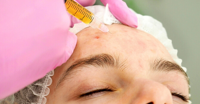 Does PRP Change Face Shape? image