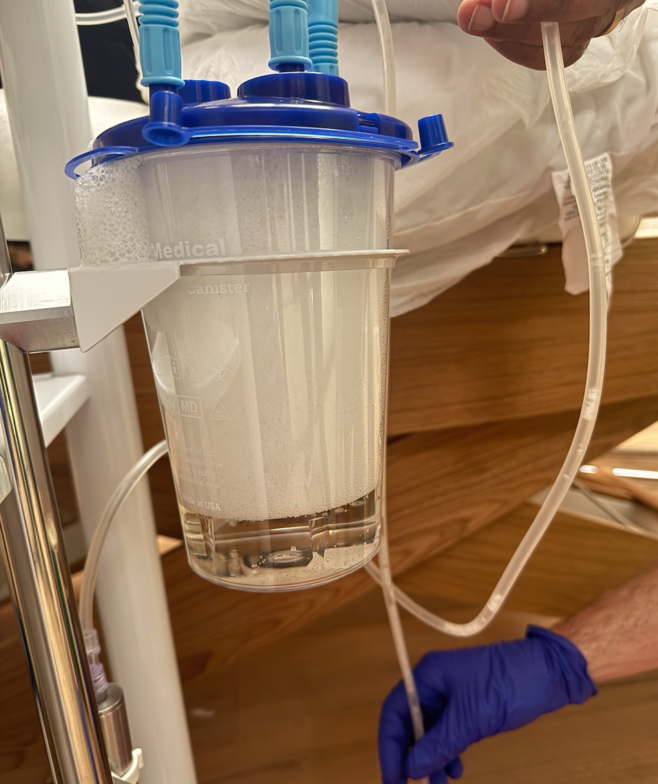 EBOO filtration