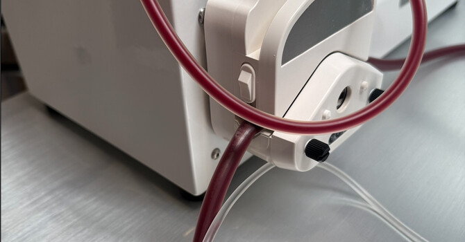 EBOO Blood Treatment  image