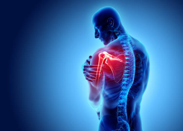 PRP For Shoulder Labrum Tear